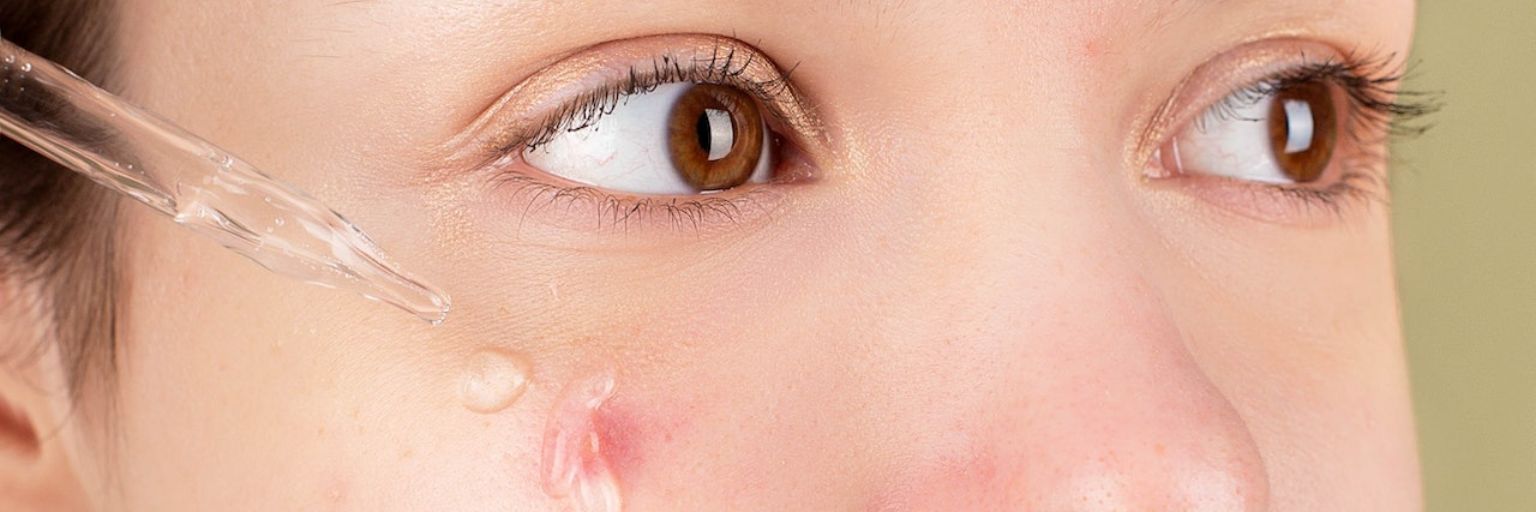Potkožne bubuljice – zašto nastaju i kako ukloniti potkožne bubuljice na licu?